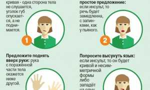 Причины развития инсульта в относительно молодом возрасте