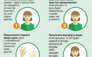 Причины развития инсульта в относительно молодом возрасте