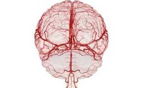 Кисты, локализующиеся в сосудистом сплетении мозга: причины развития и прогнозы при патологии