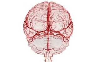 Кисты, локализующиеся в сосудистом сплетении мозга: причины развития и прогнозы при патологии