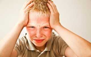 Что может предвещать развитие инсульта?