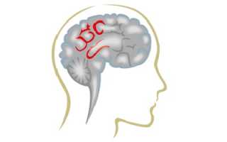 Дисциркуляторная энцефалопатия: причины и следствия патологии