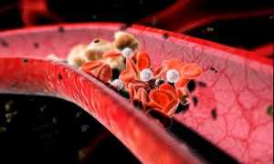 Опасность развития тромбофлебита