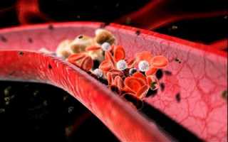 Опасность развития тромбофлебита