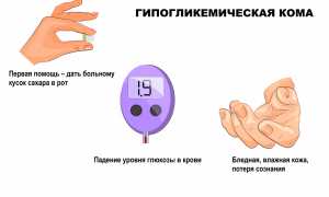 Апоплексическое коматозное состояние