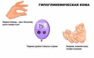Апоплексическое коматозное состояние
