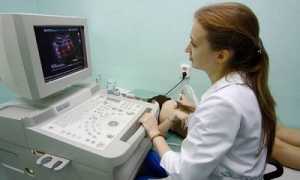Исследование сосудов с помощью ультразвука