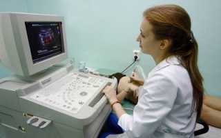 Исследование сосудов с помощью ультразвука