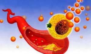 Как правильно включить в меню холестеринсодержащие продукты: основы рационального питания