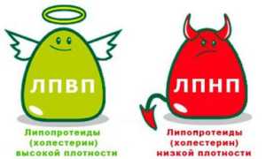 Нормы и причины отклонений показателей общего холестерина