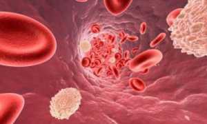 Анализ крови на холестерин: о чем говорят результаты?