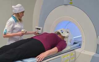 Магнитно-резонансная томография головного мозга и его сосудов