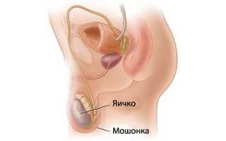 Возникновение варикоцеле в подростковом возрасте