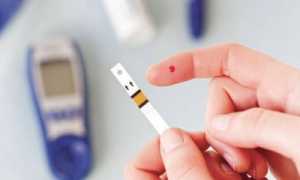 Развитие тромбоза сосудов глаза