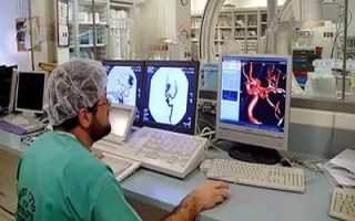 Роль ангиографии сосудов головы в современной диагностике