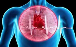 Причины, клиническая картина и методы терапии при сердчено-сосудистой недостаточности