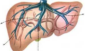 Портальная гипертензия: основные причины, симптомы, методы лечения и профилактики