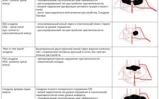Спинальный тип инсульт-патологии