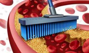 Можно ли очистить сосуды от холестерина при помощи народных средств?