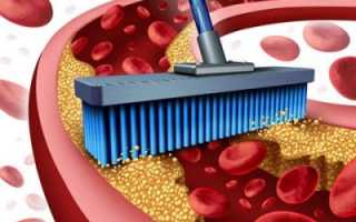 Можно ли очистить сосуды от холестерина при помощи народных средств?