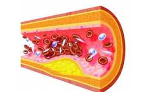 Сосудистые заболевания мозга: этиология, симптомы и последствия