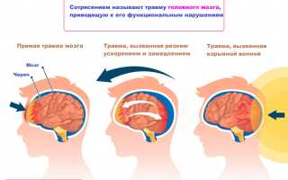 Как жить, перенеся мозговой удар?