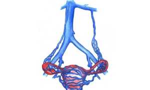 Варикоз вен влагалища: этиология, методы терапии и профилактики