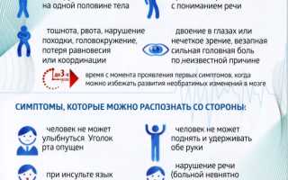 Учимся распознавать инсульт