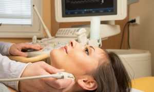 Ультразвуковое исследование сосудов головы и шеи