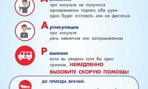 Подходят ли домашние условия для реабилитации при инсульте?