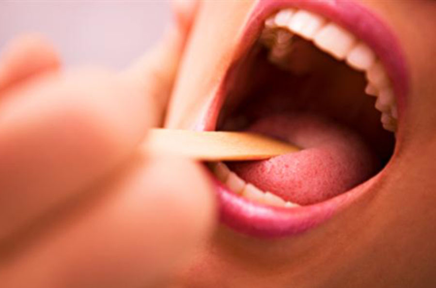 Осмотр полости рта