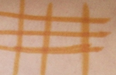 Йодная сетка