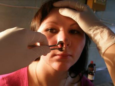 Осмотр носа