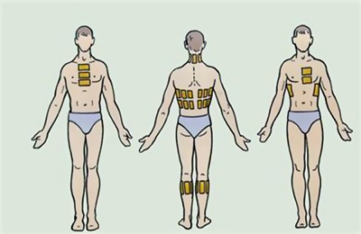 Места применения