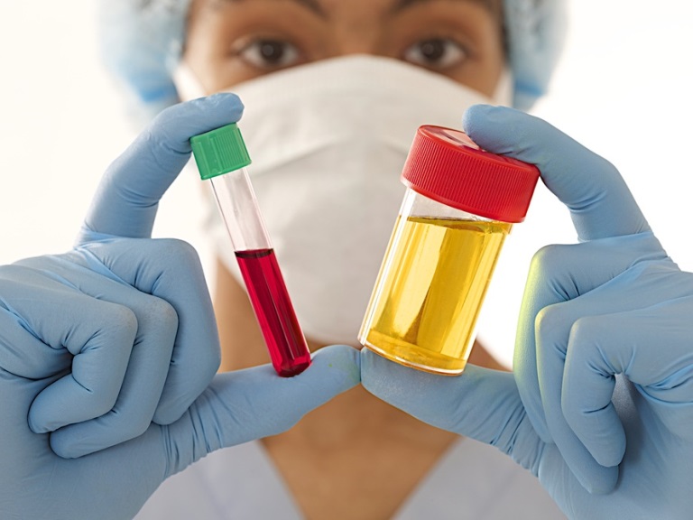 Диагностика герпетического цистита