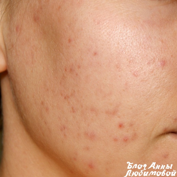 Фото красных угрей