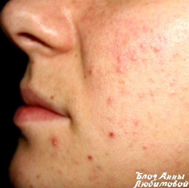 Фото красных угрей