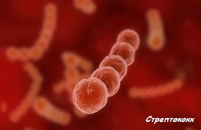Стрептококк