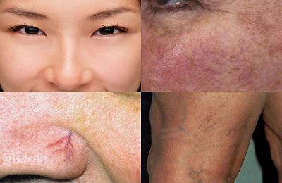 Проявления на коже