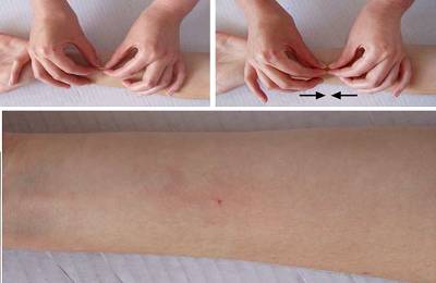 Проба щипка