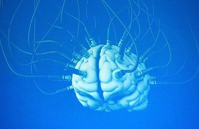 Транскраниальная электростимуляция