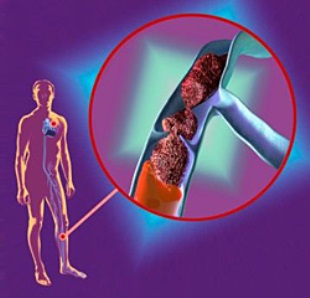 Онимение конечностей