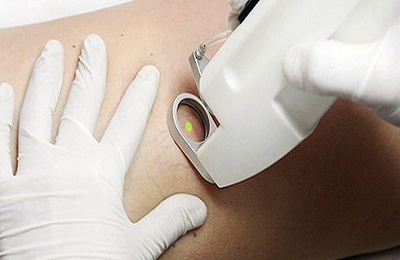 Терапия на коже