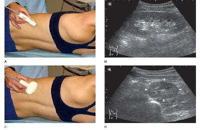 Обследование органа
