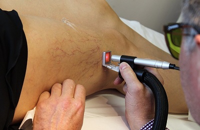 Проведение процедуры