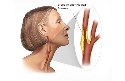 Болезнь у женщин