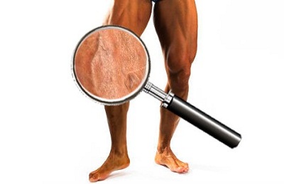 Больные ноги