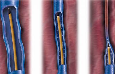 Ход проведения