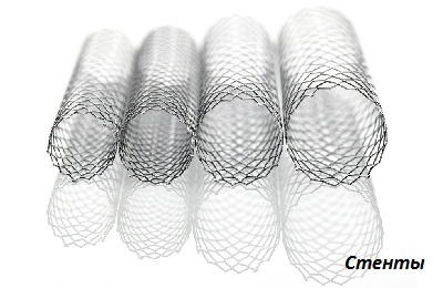 Стенты