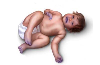 Больной ребенок